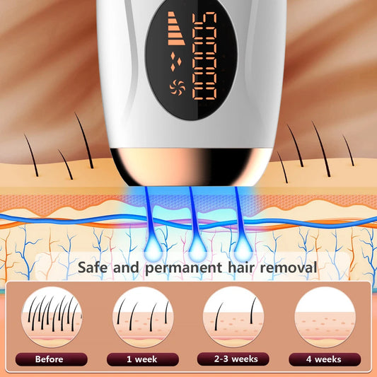 Silk Gleam™ IPL Hair Remover